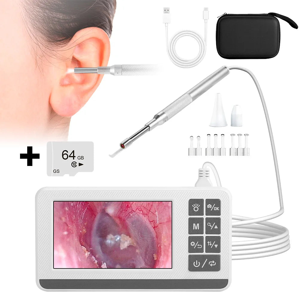 KERUI Otoscope 3.9mm Ear Endoscope Camera with 6 Lights 4.3 Inch Screen Ear Wax Removal Tool Earpicker for Kids Adults P60