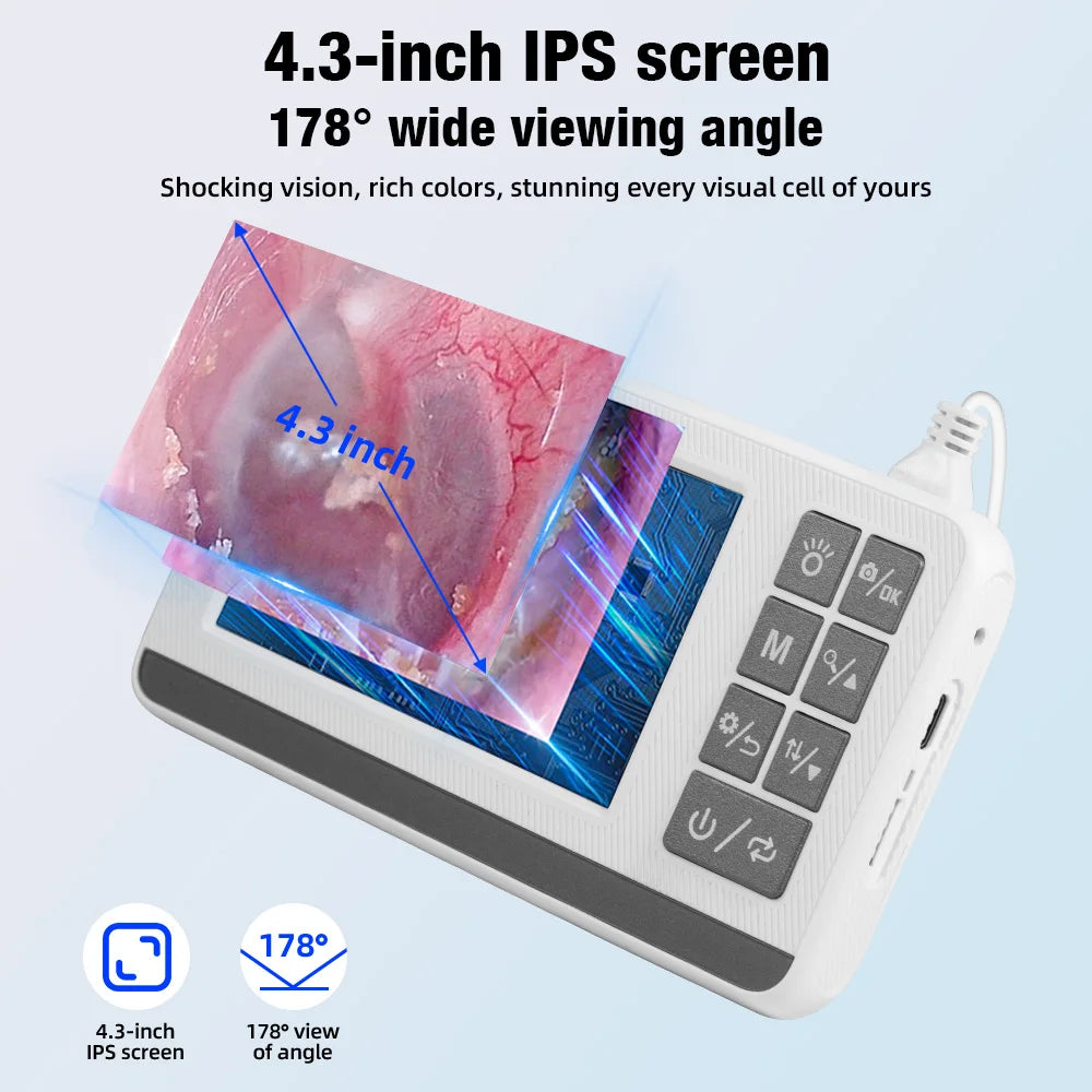 KERUI Otoscope 3.9mm Ear Endoscope Camera with 6 Lights 4.3 Inch Screen Ear Wax Removal Tool Earpicker for Kids Adults P60