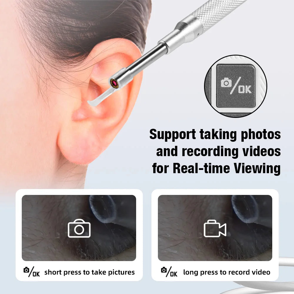 KERUI 3.9mm Ear Wax Removal Tool 4.3 Inch Screen Digital Ear Camera Ear Picker 6 LEDs Nose/Ear Cleaning Stick For Child Adult