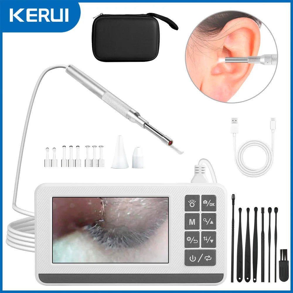 KERUI 3.9mm Ear Wax Removal Tool 4.3 Inch Screen Digital Ear Camera Ear Picker 6 LEDs Nose/Ear Cleaning Stick For Child Adult